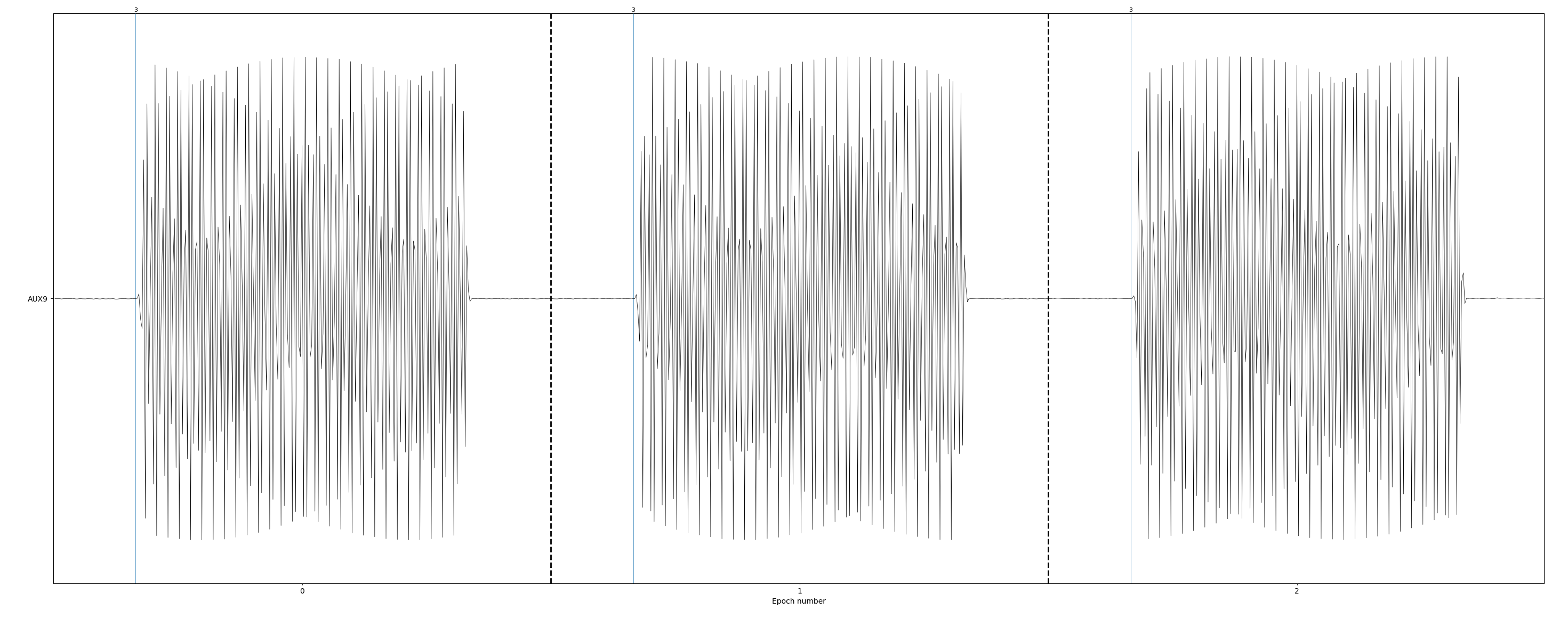 Epochs showing the trigger to sound delay